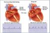 may-do-huyet-ap-bap-tay-microlife-b3-afib-advanced - ảnh nhỏ 3